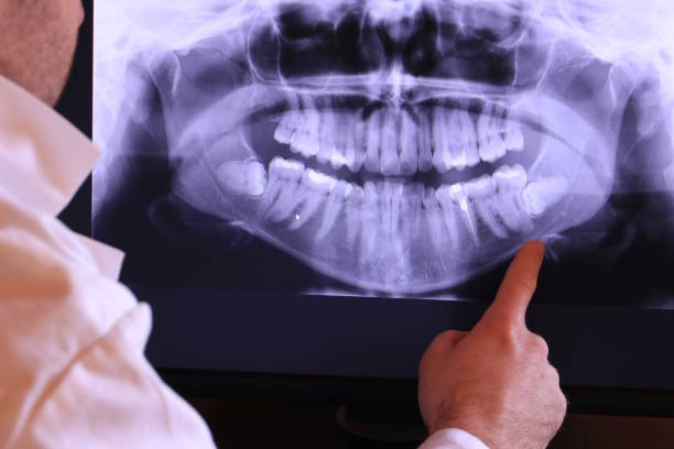 Best Emergency Dental Care for Sports Injuries in Concordia, KS