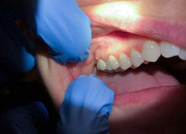 Best Walk-In Emergency Dental Services in Concordia, KS
